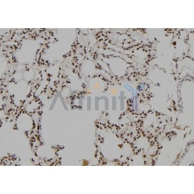 LHX8 Antibody - DF6778 at 1/100 staining Rat lung tissue by IHC-P.