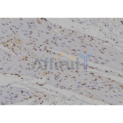 RUNX1 / AML1 Antibody - DF6785 at 1/100 staining Human gastric tissue by IHC-P.