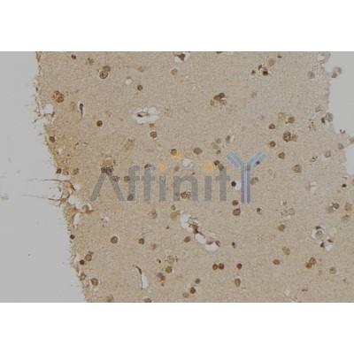 EEF2 Antibody - DF6798 at 1/100 staining Human brain tissue by IHC-P.