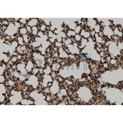 Hck Antibody - DF6807 at 1/100 staining Mouse lung tissue by IHC-P.