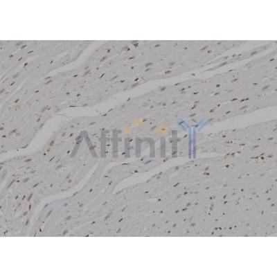 Ki67 Antibody - DF6818 at 1/100 staining Rat heart tissue by IHC-P.