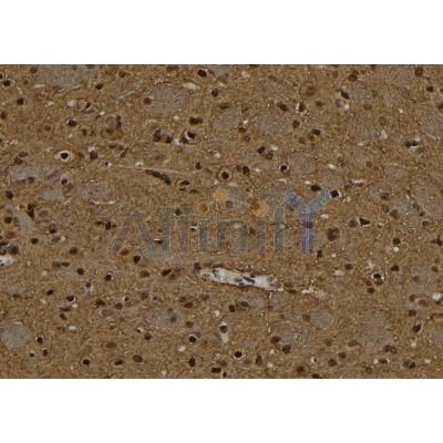 PPP4C Antibody - DF6833 at 1/100 staining Rat brain tissue by IHC-P.