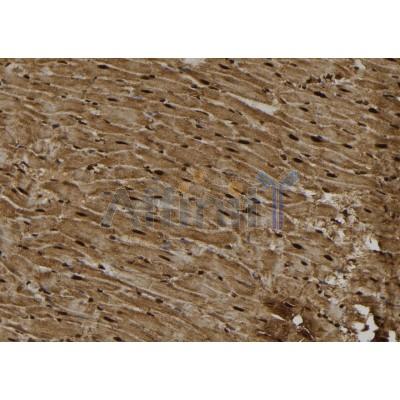 PKC epsilon Antibody - DF6834 at 1/100 staining Rat heart tissue by IHC-P.