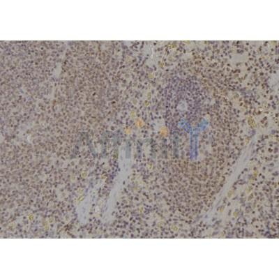 UBB Antibody - DF6852 at 1/100 staining Rat spleen tissue by IHC-P.