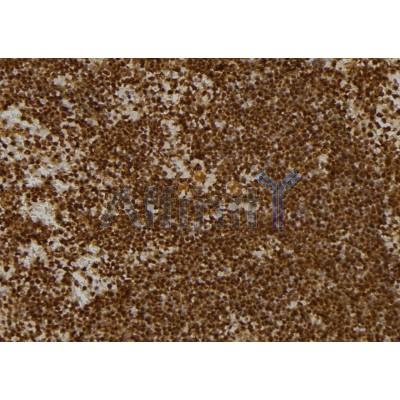 KBTBD3 Antibody - DF6875 at 1/100 staining Mouse spleen tissue by IHC-P.