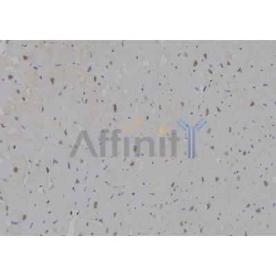 PMS1 Antibody - DF6906 at 1/100 staining Human heart tissue by IHC-P.