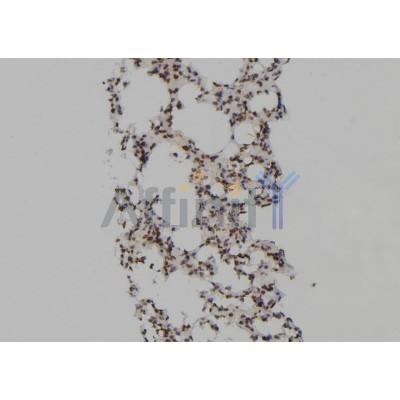 PSMA6 Antibody - DF6911 at 1/100 staining Mouse lung tissue by IHC-P.