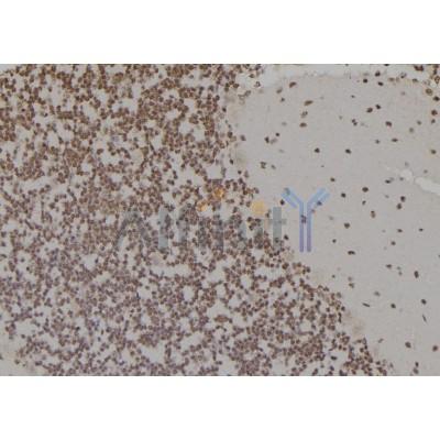 RPA32/RPA2 Antibody - DF6912 at 1/100 staining Rat brain tissue by IHC-P.