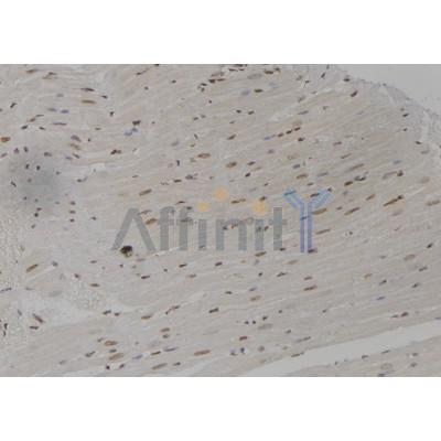 Vitamin D Receptor Antibody - DF6917 at 1/100 staining Rat heart tissue by IHC-P.