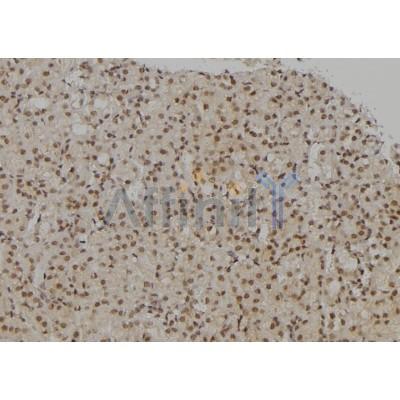 UHRF2 Antibody - DF6930 at 1/100 staining Rat kidney tissue by IHC-P.