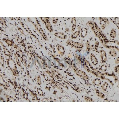 EPB41 Antibody - DF6959 at 1/100 staining Human kidney tissue by IHC-P.