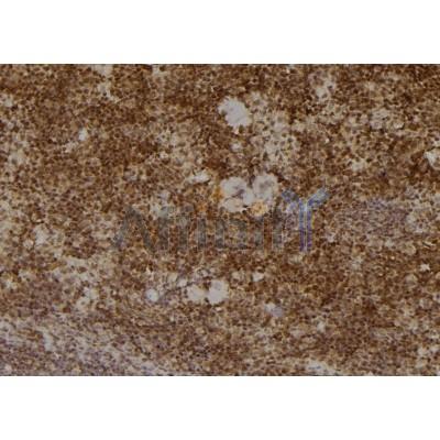 PSMA2 Antibody - DF6972 at 1/100 staining Mouse spleen tissue by IHC-P.