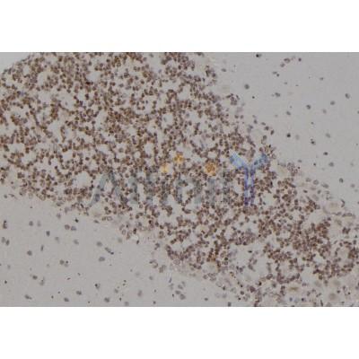 PSMC4 Antibody - DF6973 at 1/100 staining Rat brain tissue by IHC-P.