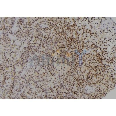 PCBP2 Antibody - DF6991 at 1/100 staining Rat spleen tissue by IHC-P.