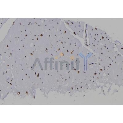 SUMO2 Antibody - DF7024 at 1/100 staining Human heart tissue by IHC-P.
