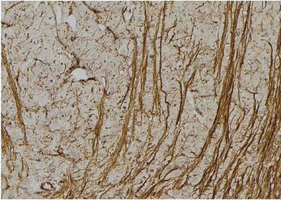 MAP2 Antibody - DF7025 at 1/100 staining rat brain tissue by IHC-P.