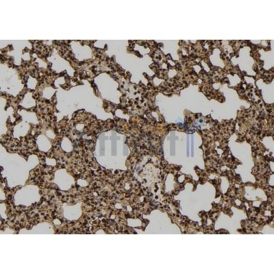 N-WASP Antibody - DF7029 at 1/100 staining Mouse lung tissue by IHC-P.