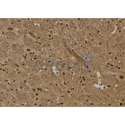 Vimentin Antibody - DF7035 at 1/100 staining Rat brain tissue by IHC-P.