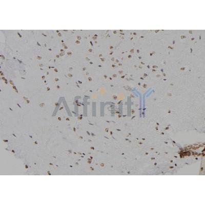 CDK20 Antibody - DF7056 at 1/100 staining Mouse brain tissue by IHC-P.