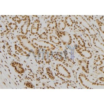 FAM81B Antibody - DF7063 at 1/100 staining Human kidney tissue by IHC-P.