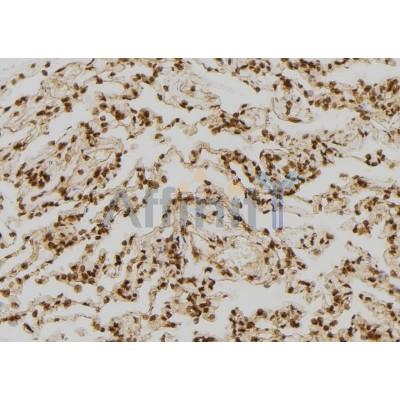 FABP7 Antibody - DF7065 at 1/100 staining Human lung tissue by IHC-P.