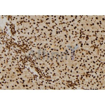 PSMD3 Antibody - DF7082 at 1/100 staining Mouse liver tissue by IHC-P.