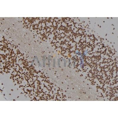 HOXC8 Antibody - DF7128 at 1/100 staining Rat brain tissue by IHC-P.
