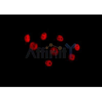 HOXC8 Antibody - DF7128 staining Hela cells by IF/ICC.