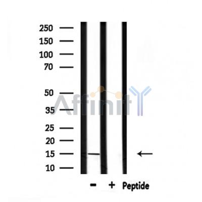 KISS1 Antibody - Western blot analysis of extracts from rat brain, using KISS1  Antibody.