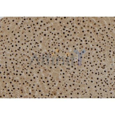 B Raf Antibody - DF7134 at 1/100 staining Rat liver tissue by IHC-P.