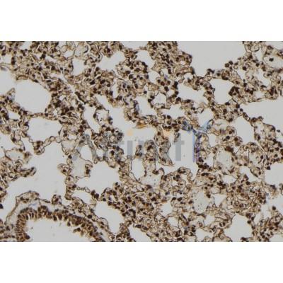 PDX1 Antibody - DF7170 at 1/100 staining Rat lung tissue by IHC-P.