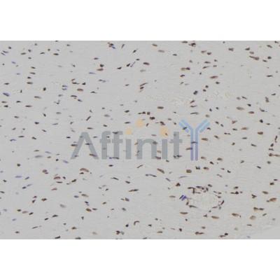 INA Antibody - DF7191 at 1/100 staining Rat heart tissue by IHC-P.