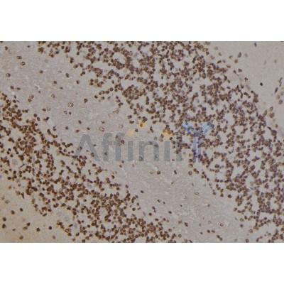 PARP1 Antibody - DF7198 at 1/100 staining Rat brain tissue by IHC-P.