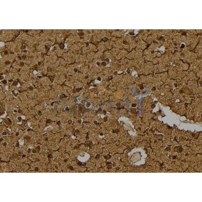 MSH6 Antibody - DF7233 at 1/100 staining Human brain tissue by IHC-P.