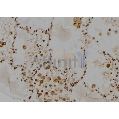 RAD23A Antibody - DF7241 at 1/100 staining Human lung tissue by IHC-P.