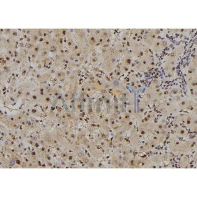 FAM160B2 Antibody - DF7245 at 1/100 staining Human liver tissue by IHC-P.