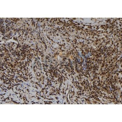 AIMP1 Antibody - DF7261 at 1/100 staining Human spleen tissue by IHC-P.