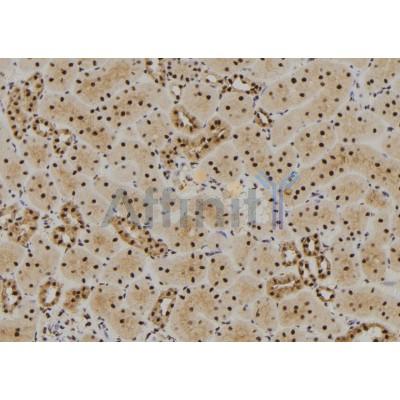 FABP1 Antibody - DF7267 at 1/100 staining Rat kidney tissue by IHC-P.