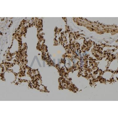 GMNN Antibody - DF7270 at 1/100 staining Rat lung tissue by IHC-P.
