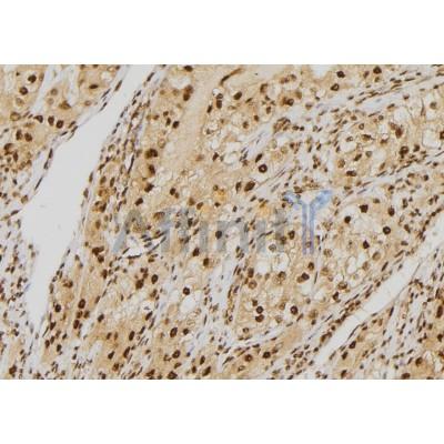 NDC80 Antibody - DF7329 at 1/100 staining Human kidney tissue by IHC-P.