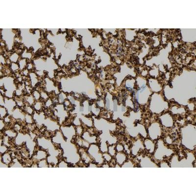 PEPD Antibody - DF7333 at 1/100 staining Mouse lung tissue by IHC-P.