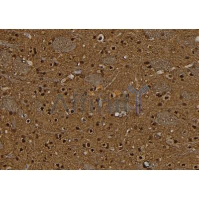 BCL11A Antibody - DF7345 at 1/100 staining Rat brain tissue by IHC-P.
