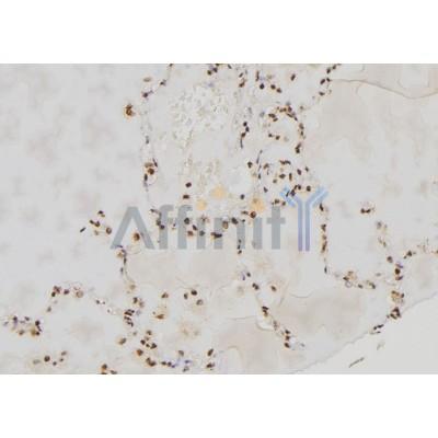PER3 Antibody - DF7349 at 1/100 staining Human lung tissue by IHC-P.