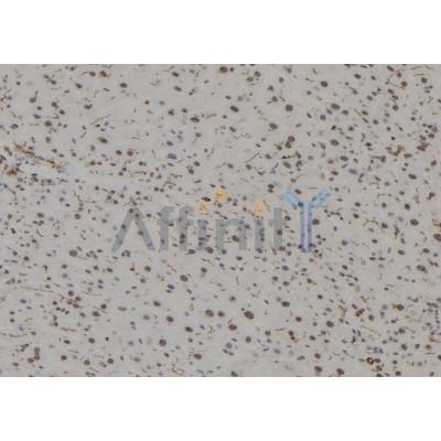 IRAK3 Antibody - DF7355 at 1/100 staining Mouse liver tissue by IHC-P.
