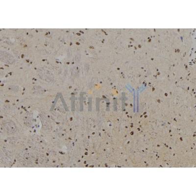 PFKM Antibody - DF7362 at 1/100 staining Rat brain tissue by IHC-P.