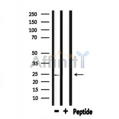 SIGMAR1 Antibody - Western blot analysis of extracts from mouse muscle, using SIGMAR1 Antibody.