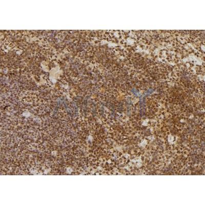 S100A11 Antibody - DF7368 at 1/100 staining Mouse spleen tissue by IHC-P.