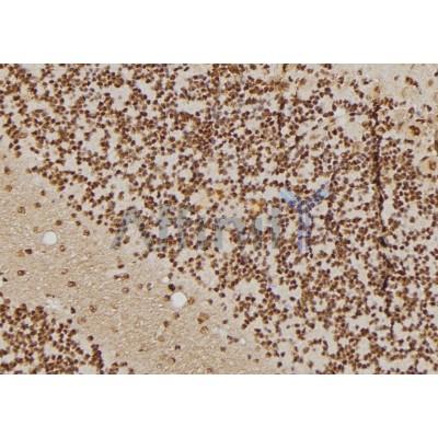 Hsp40 Antibody - DF7382 at 1/100 staining Rat brain tissue by IHC-P.