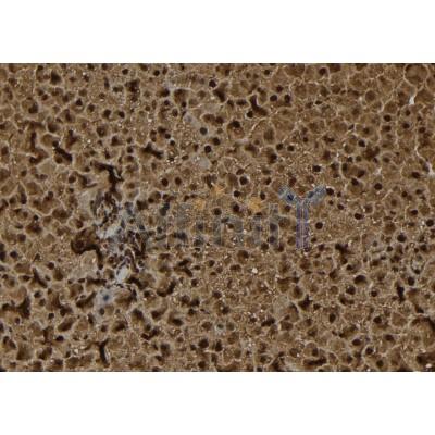 DDX3 Antibody - DF7429 at 1/100 staining Rat liver tissue by IHC-P.