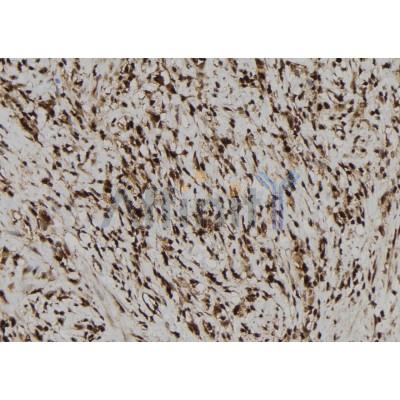 NLRP3 Antibody - DF7438 at 1/100 staining Human gastric tissue by IHC-P.